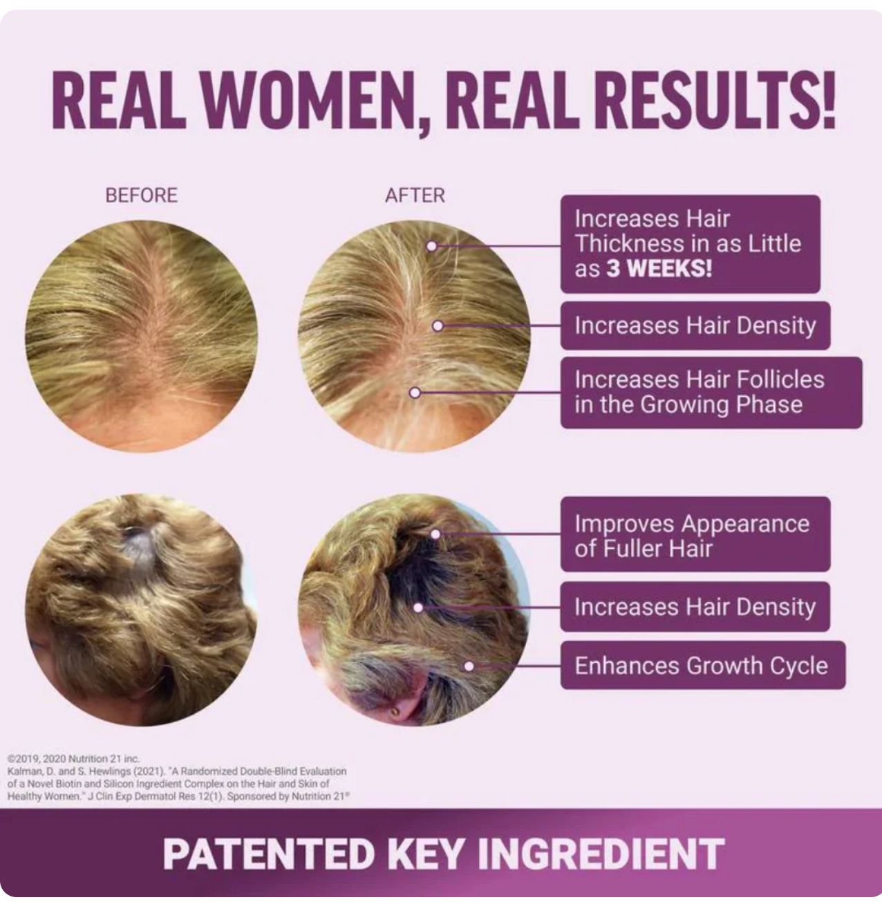 Hair Growth Gummies - Valoria