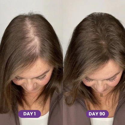Hair Growth Gummies - Valoria
